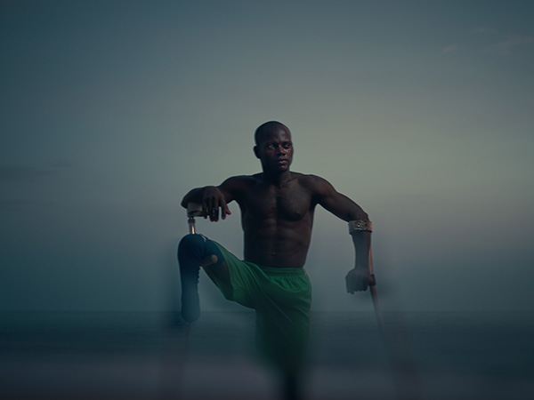 Athletic Black man with a prosthetic leg poses outdoors against a diffused background, showcasing physical strength and determination.