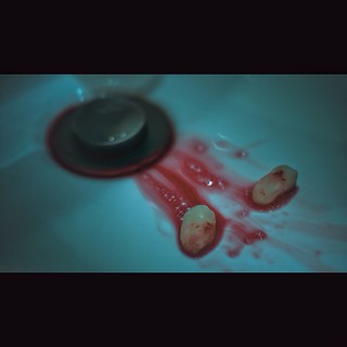 An eye-level, medium shot shows two teeth with blood in a white sink. A silver drain is also visible, suggesting a dental procedure.