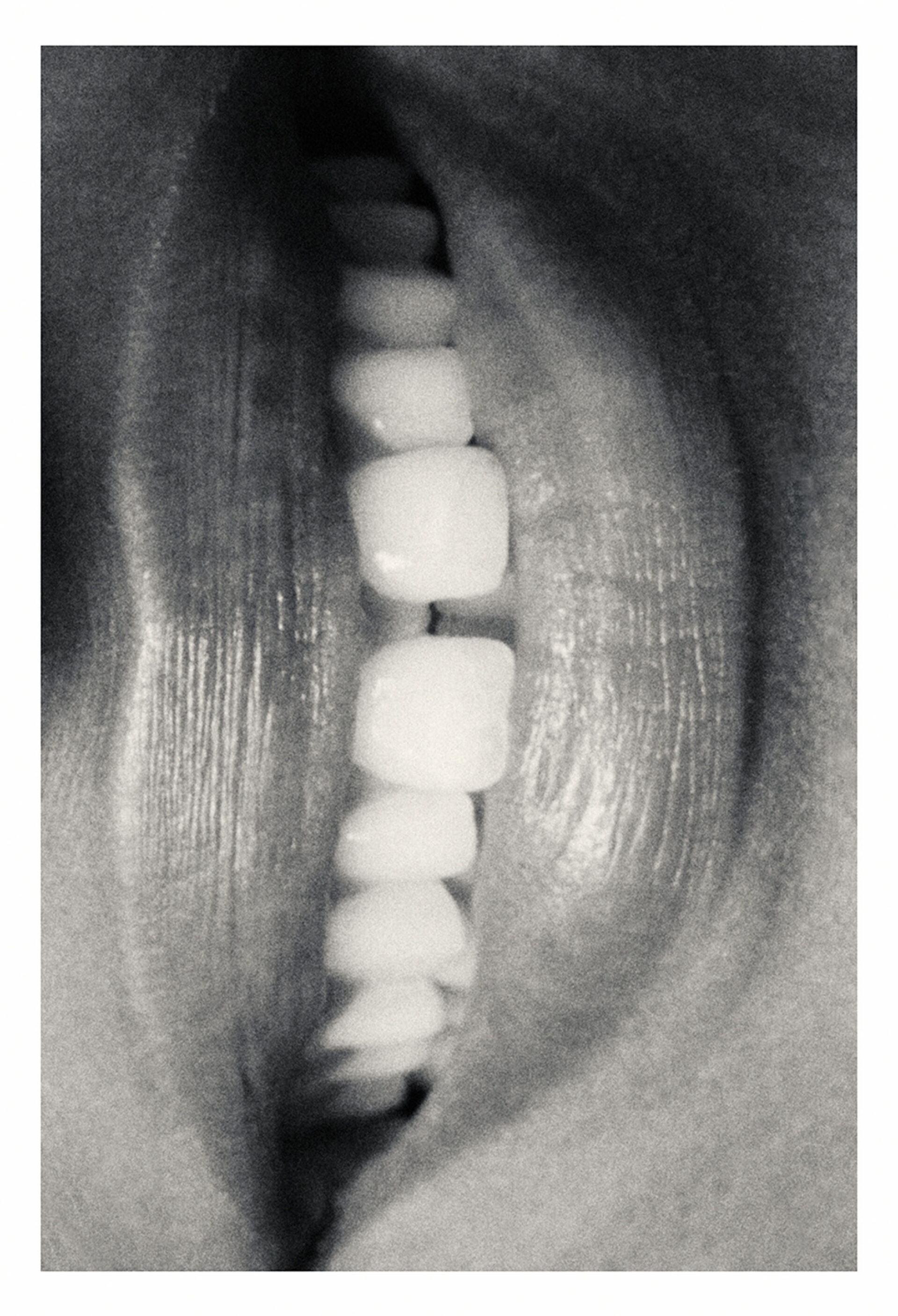 Close-up black and white studio shot of open human mouth showing clean, white teeth. Lips are parted revealing a full set.