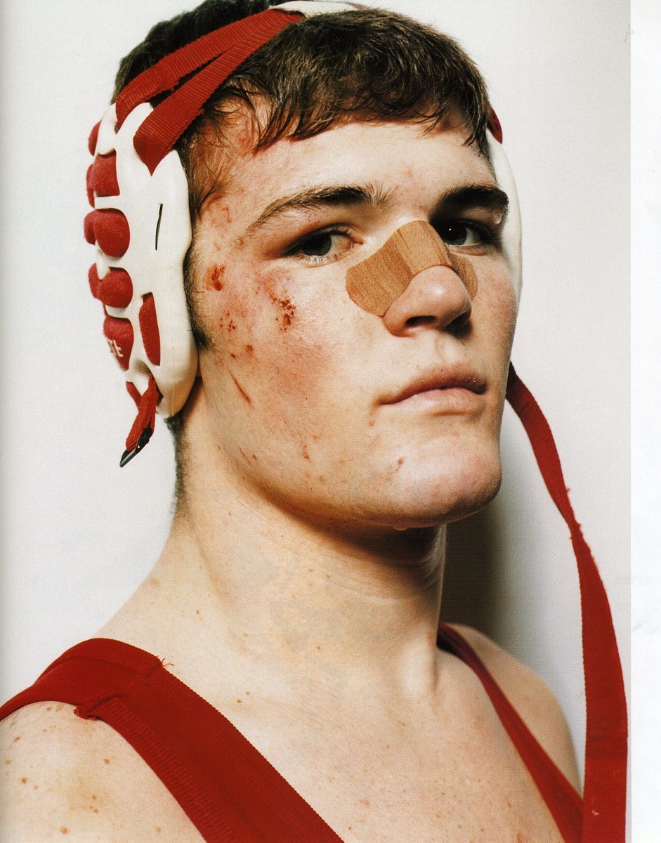 Portrait of a male wrestler with protective headgear and a bandage on his nose, indicating a recent match or training session.