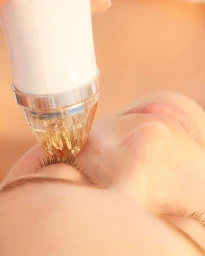 Close-up of a handheld cosmetic device with a clear microneedle tip applied to a person face near the eye by Jocelyn Petroni