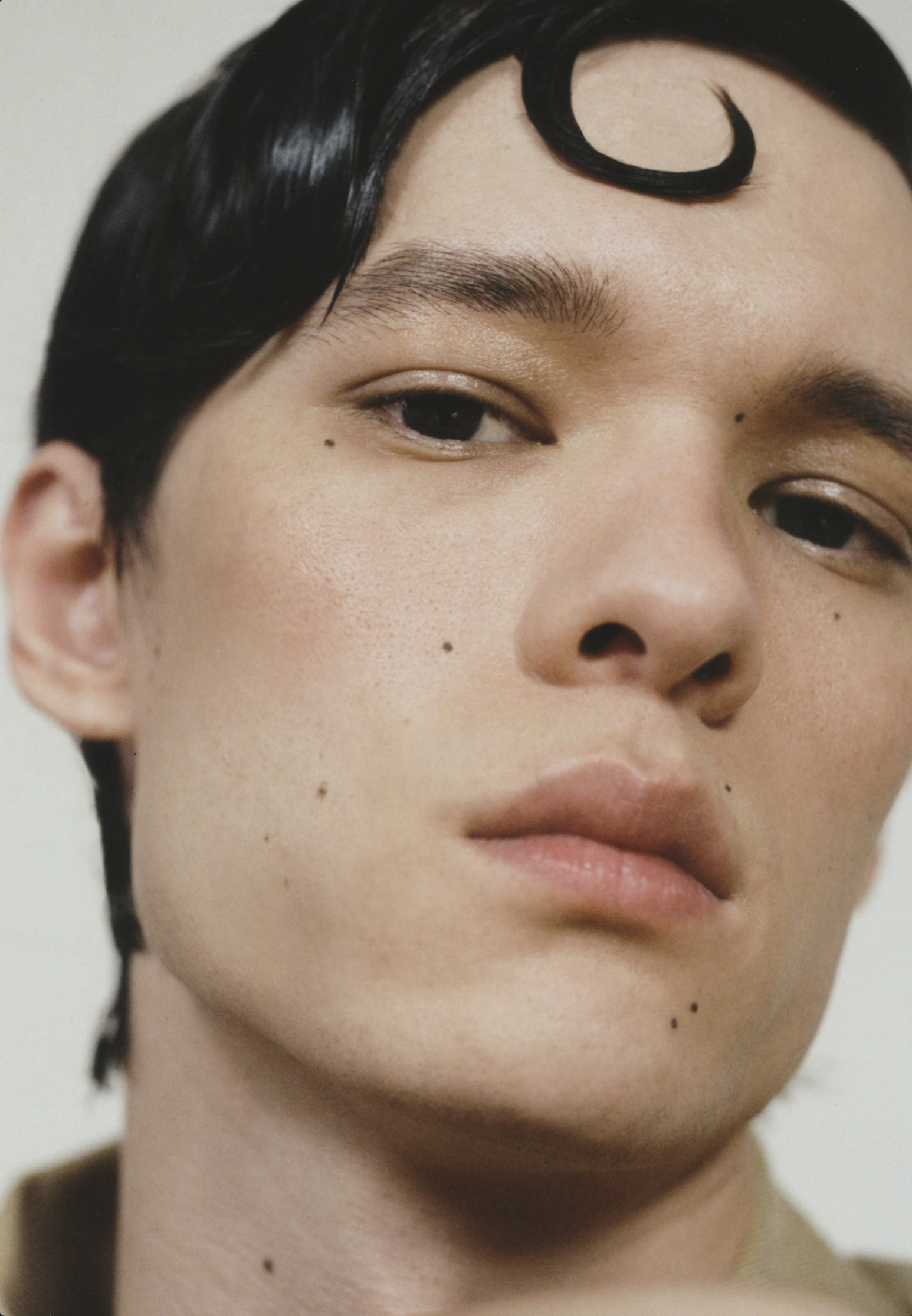 Close-up portrait of a young adult male with a unique crescent-shaped hairstyle, fair skin, and distinct mole marks against a light background.