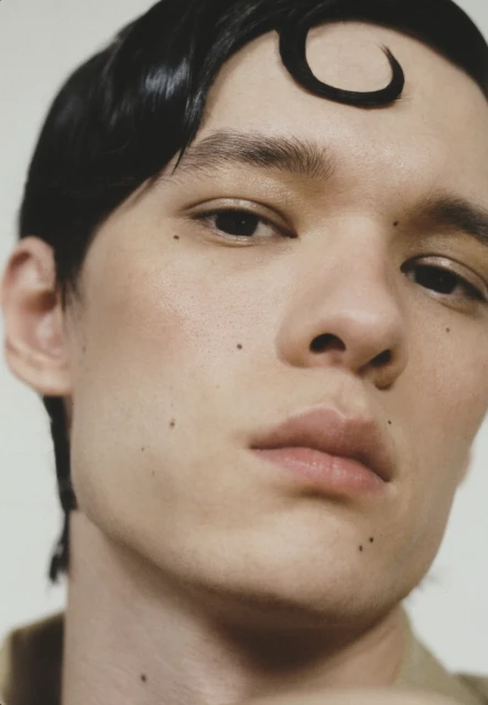 Close-up portrait of a young adult male with a unique crescent-shaped hairstyle, fair skin, and distinct mole marks against a light background.