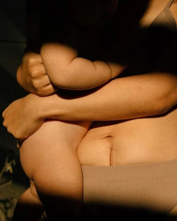 Close-up of a person holding a baby in warm lighting, showing a postpartum abdomen with a scar.