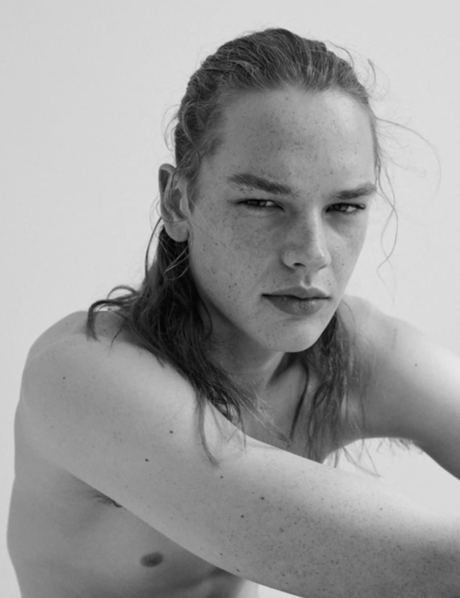 Close-up monochrome portrait of a young man with long hair and freckles looking directly at the camera against a plain white background.