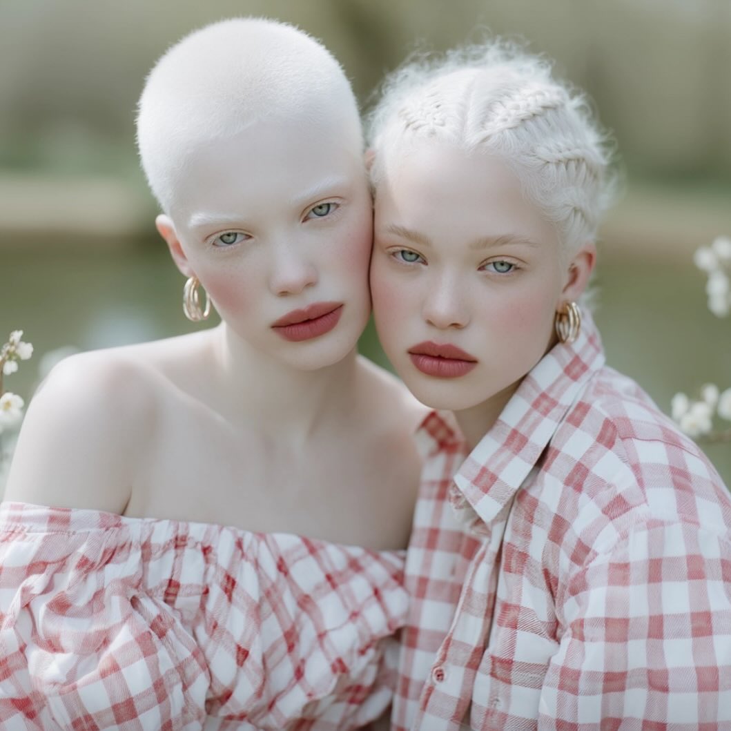 Close-up of two albino women with fair skin, wearing matching plaid shirts and earrings, in a soft, outdoor setting.