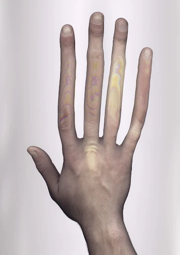 Close-up of a hand, showing all five fingers, palm facing up, skin texture, and colorful light patterns on fingers. Against white backdrop.