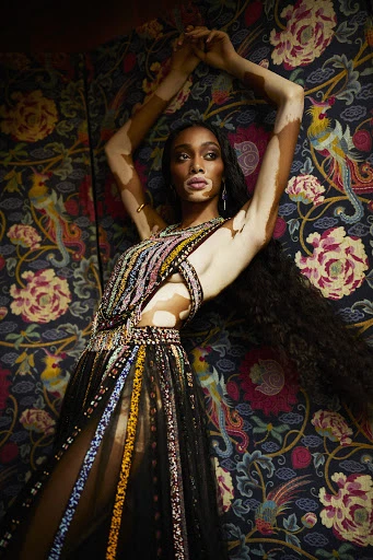 A model with vitiligo poses in a black gown with colourful embellishments against an ornate floral and avian pattern backdrop.