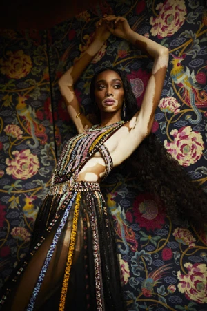 A model with vitiligo poses in a black gown with colourful embellishments against an ornate floral and avian pattern backdrop.