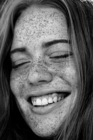 Close-up portrait of a smiling young woman with heavy freckles across her face and nose in monochrome.
