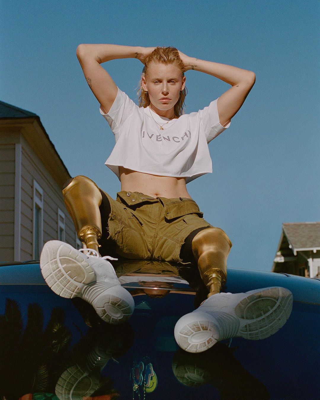 Fashion photo of a woman with prosthetic legs sitting on the hood of a car. She wears white sneakers and a cropped tee shirt.