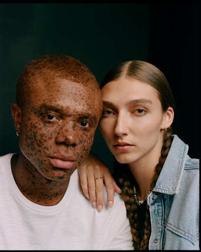 Studio shot of a light-skinned adult female with braided hair in a denim jacket, posed next to an adult male with vitiligo wearing a white t-shirt.
