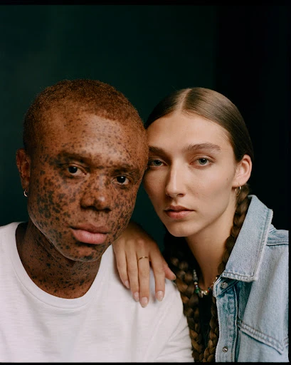 Studio shot of a light-skinned adult female with braided hair in a denim jacket, posed next to an adult male with vitiligo wearing a white t-shirt.
