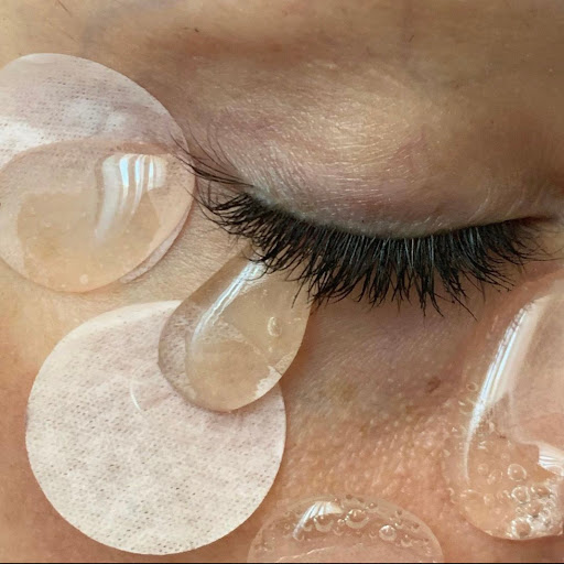 Close-up of a person's eye with long eyelashes, surrounded by multiple round, clear skincare patches on their face.