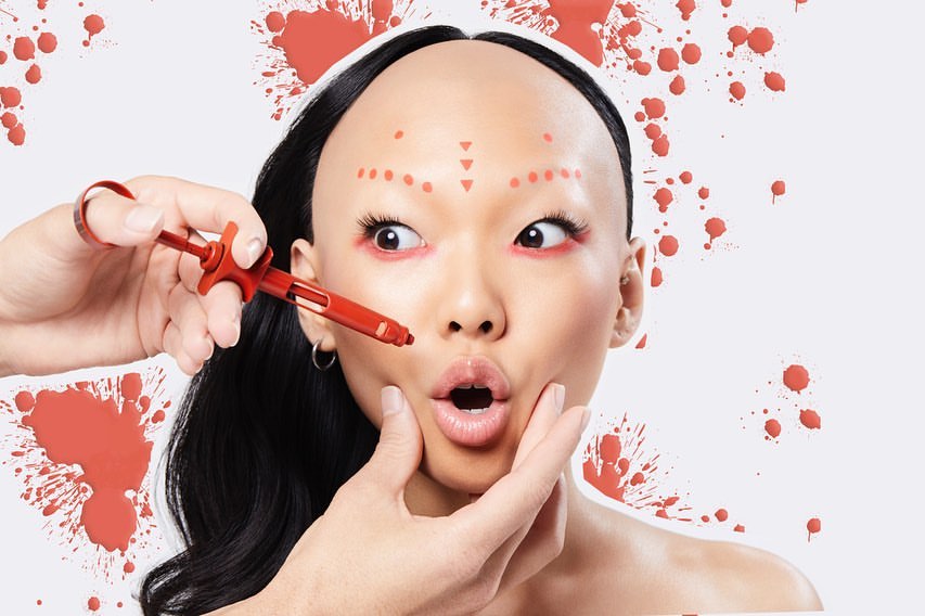 Asian woman with red makeup dots and surprised expression while someone is holding a syringe near her face with a light background.