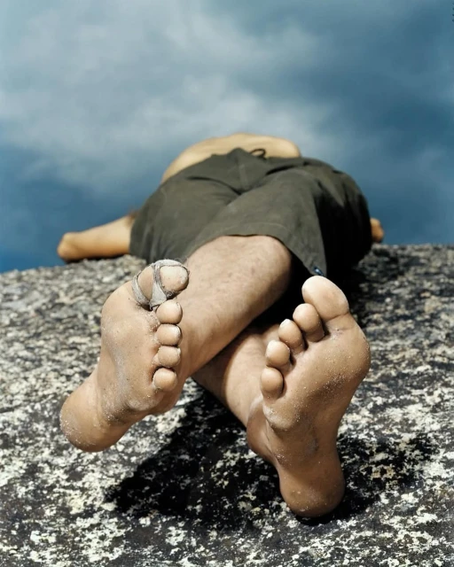 Man resting on a rock with his feet crossed and a bandaged toe, set against a partly cloudy sky in an outdoor environment.