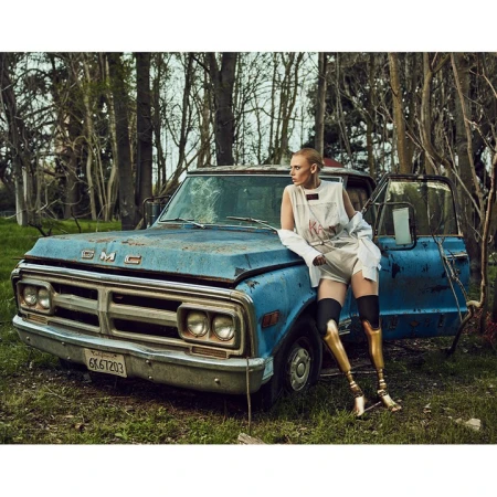 An adult female poses in front of a blue GMC truck with gold prosthetic legs. She wears shorts and a loose white top.