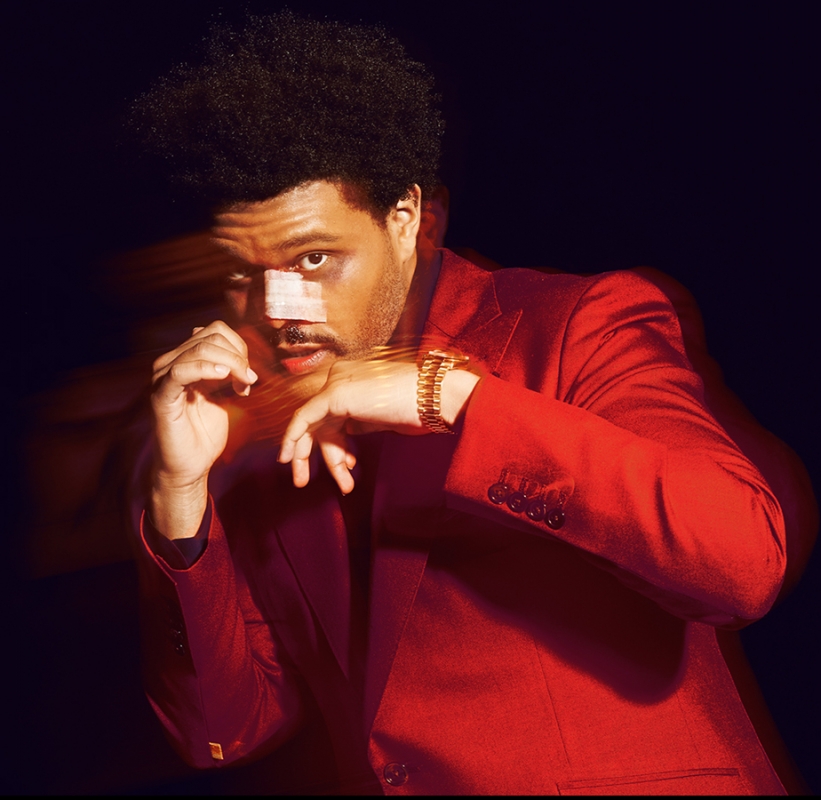 Close-up portrait of a Black adult male with bandages on his face, wearing a red suit and gold watch against a black background.