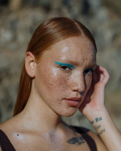 Close-up of a young woman with vitiligo and freckles, gazing calmly at the camera with turquoise eyeliner, against an outdoor background.