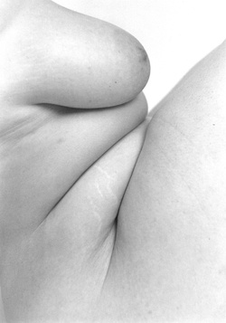 Close-up black and white photo of a human torso with skin folds, creating abstract shapes and patterns with light and shadow.