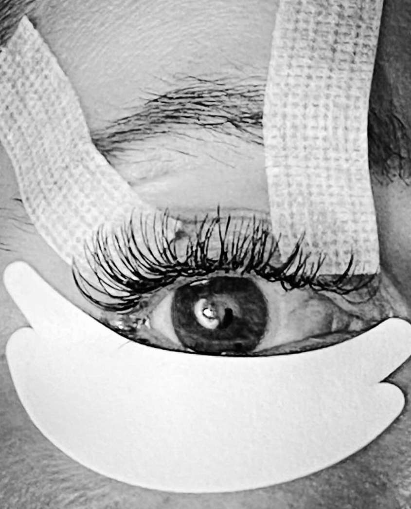 Close-up black and white image of a woman's eye with long eyelashes, surgical tape, and cosmetic under eye patch.