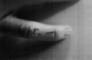 Monochrome macro photograph of a person finger showing detailed skin texture and minor marks