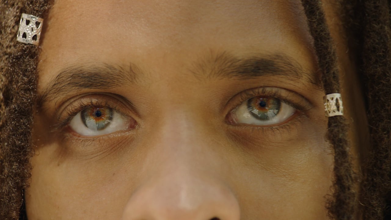 A close-up shot captures the eyes of an individual with textured skin and striking heterochromia, set against a blurred, light backdrop.