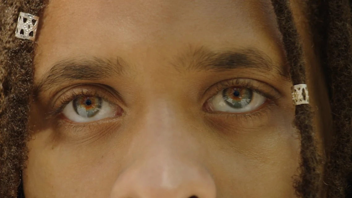 A close-up shot captures the eyes of an individual with textured skin and striking heterochromia, set against a blurred, light backdrop.