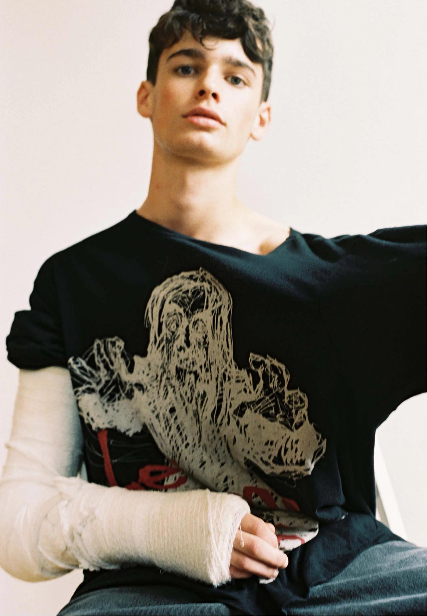 Young man with both arms in white plaster casts wearing a black t-shirt with graphic print posing in front of a neutral wall.