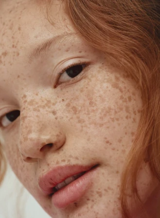 Close-up portrait of a woman with red hair and heavy freckles covering her face, shot by Amy Harrity.