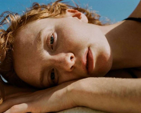 Close-up portrait of a woman with red hair and freckles resting her chin on her hands under a clear blue sky