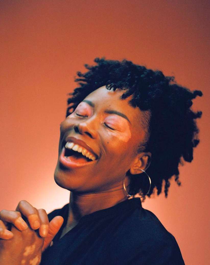 Smiling African-American woman with vitiligo poses in a black shirt against a coral background, eyes closed, hands clasped near her chest.