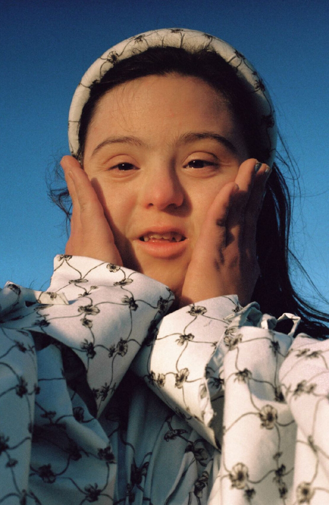 Close-up portrait of a young girl with Down syndrome smiling and holding her hands to her cheeks against a bright blue sky.