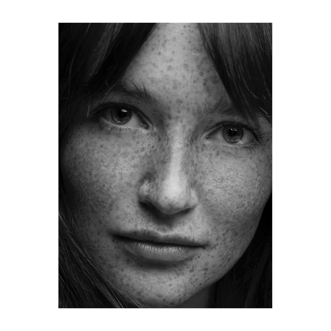 Close-up black and white portrait of a woman with heavy freckles across her face by photographer Lauren Dukoff.