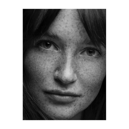 Close-up black and white portrait of a woman with heavy freckles across her face by photographer Lauren Dukoff.