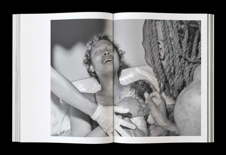 Black and white image of a woman in labor with medical professionals attending to her and the newborn baby, captured on a book spread.