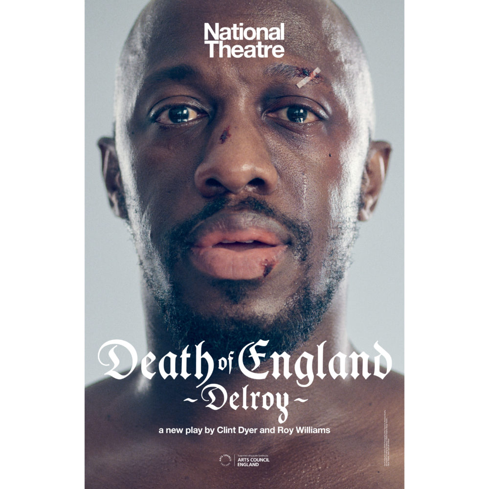 Close-up of a man with cuts and bruises on his face looking directly at the camera, promoting the 'Death of England' play.