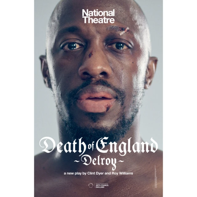 Close-up of a man with cuts and bruises on his face looking directly at the camera, promoting the 'Death of England' play.