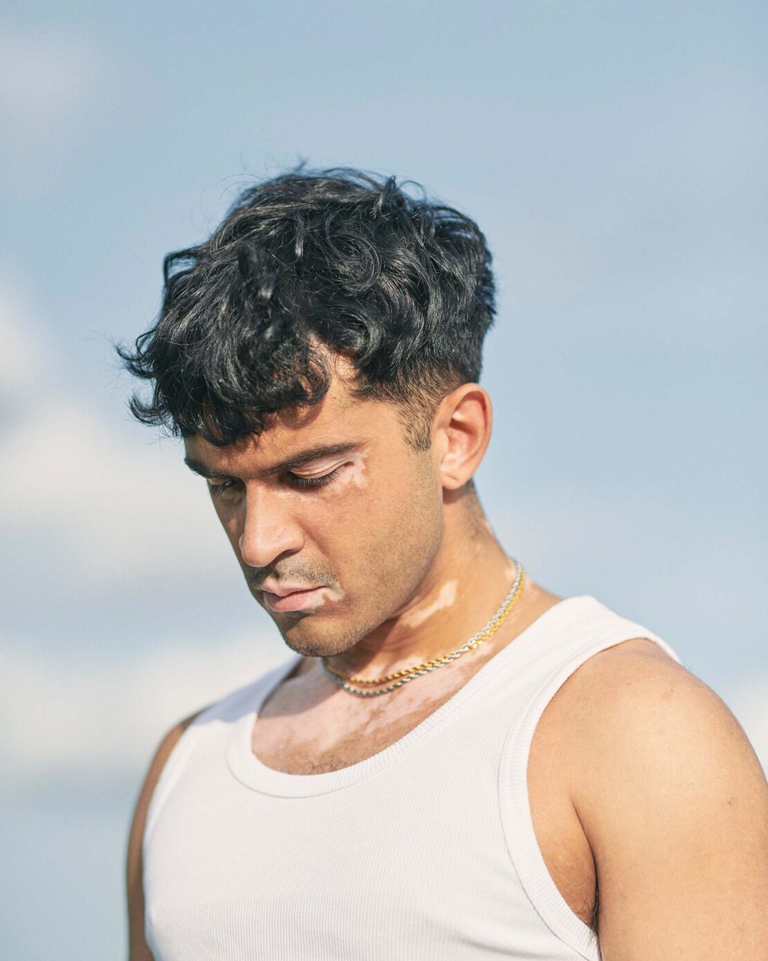 Portrait of a man with dark curly hair and vitiligo wearing a white tank top against a clear sky background