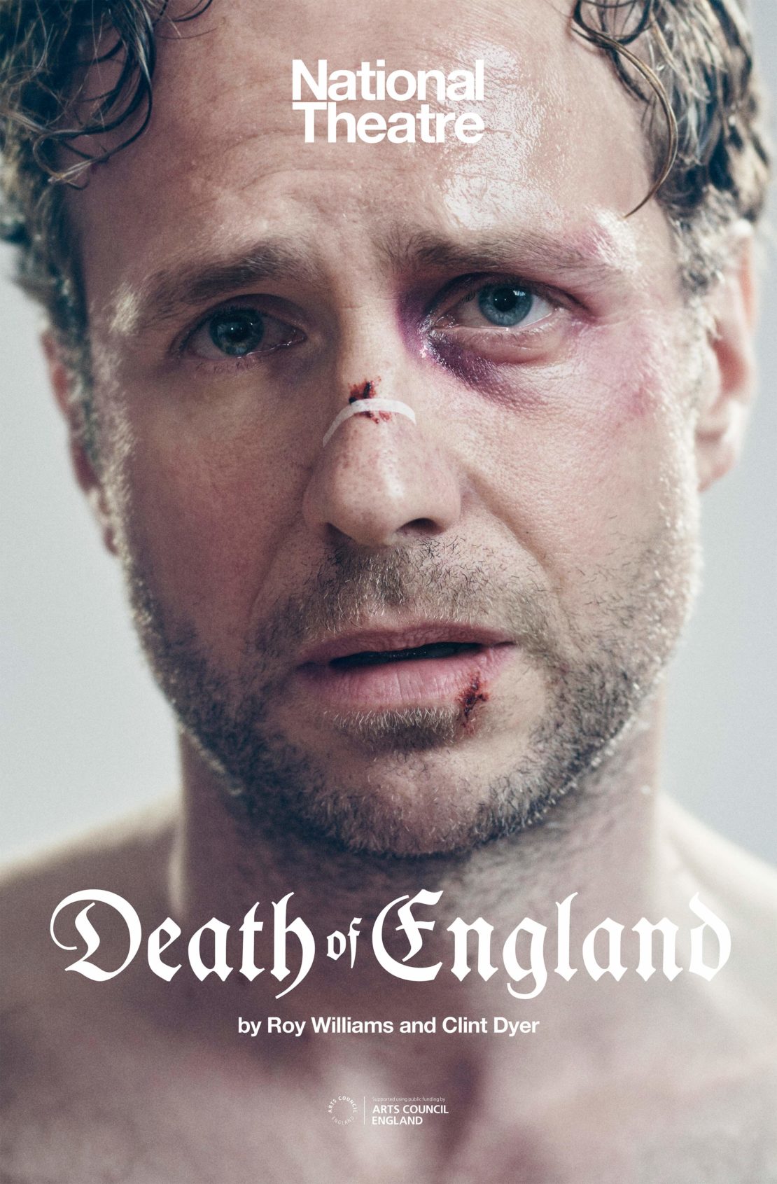 Theatre poster featuring an adult man with cuts and bruising on his face, a bandage on his nose, and the text 'Death of England'.