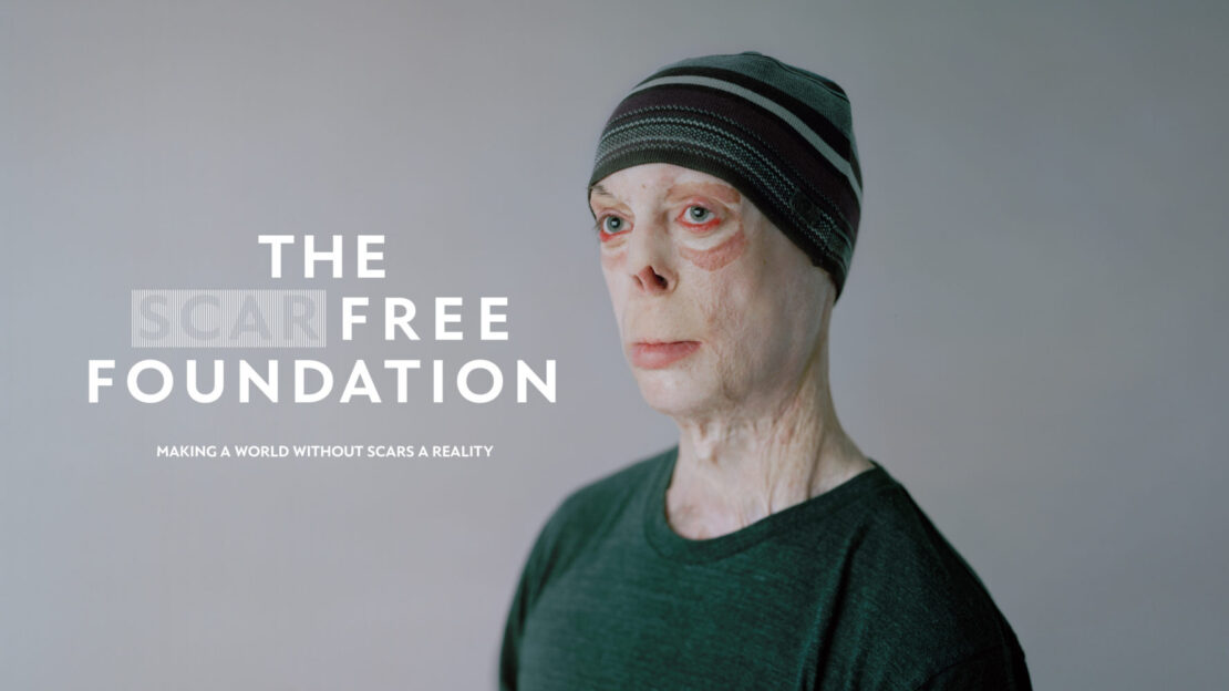 Portrait of an adult wearing a striped beanie and green shirt, next to the words: The Scar Free Foundation, Making a World Without Scars a Reality.