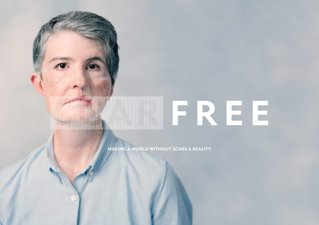 Portrait of an adult woman with short gray hair wearing a light blue shirt against a light gray gradient background with the text 'FREE'.