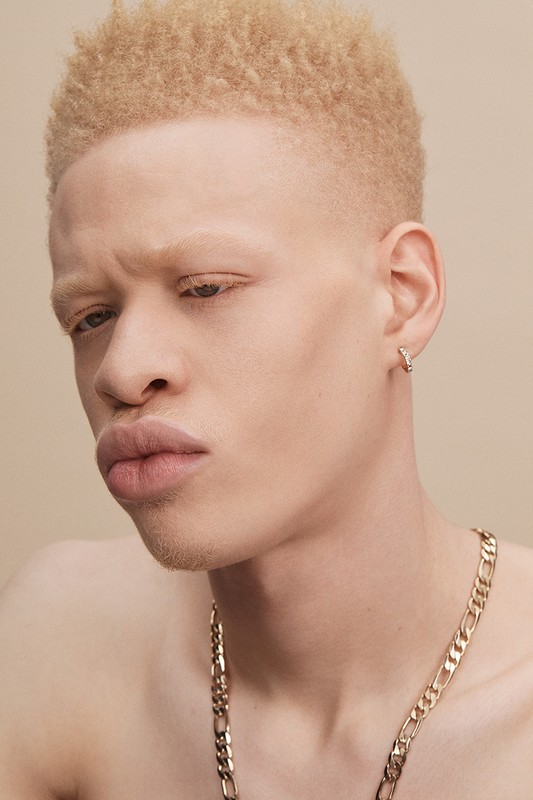 Close-up portrait of an albino adult male with blond hair wearing a gold chain necklace against a neutral beige background.