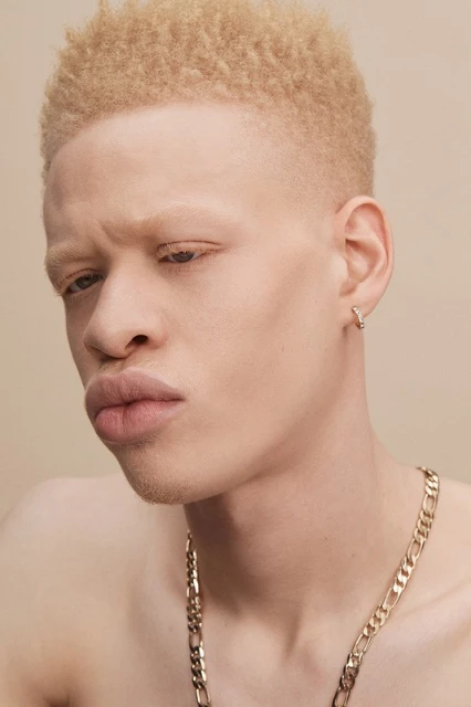 Close-up portrait of an albino adult male with blond hair wearing a gold chain necklace against a neutral beige background.