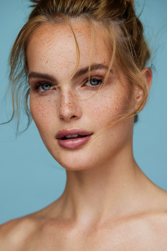 Close-up beauty portrait of a fair-skinned woman with heavy freckles, blue eyes, and loose blonde strands of hair against a blue background.