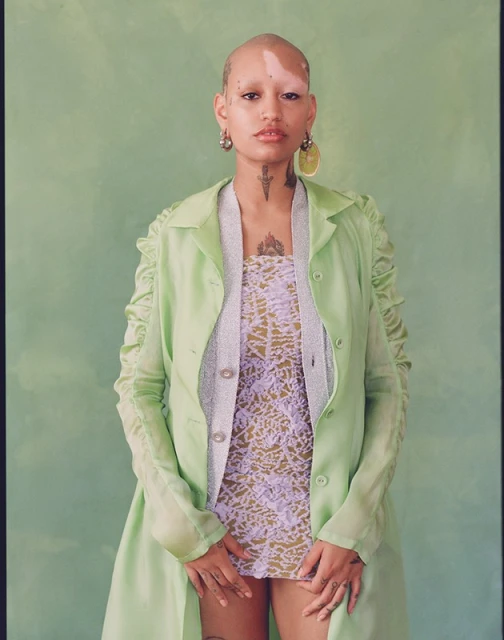 Portrait of a woman with vitiligo wearing a green coat and patterned dress, standing against a green studio backdrop in soft, diffused light.