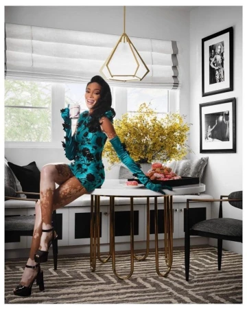 Model Winnie Harlow in a green floral mini dress and gloves, sitting on a table in an indoor setting with donuts.