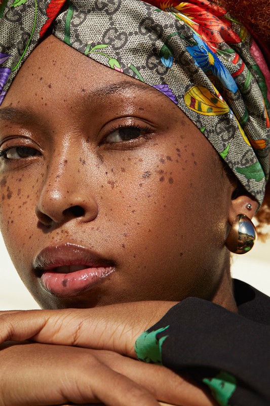 Close-up portrait of a young Black woman with freckles wearing a Gucci floral head wrap and gold hoop earrings looking pensively at the camera.