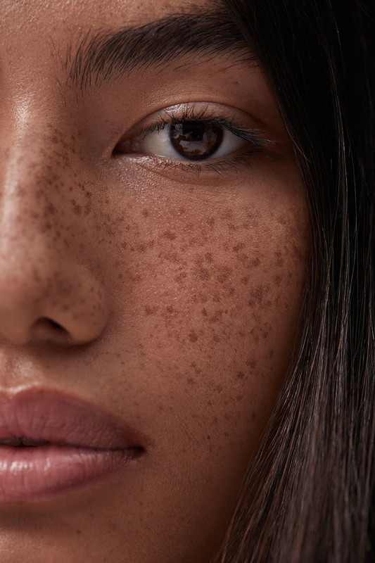 Close-up portrait of a woman's face highlighting natural freckles, dark brown eyes, and detailed skin texture.