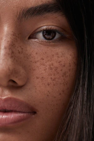 Close-up portrait of a woman's face highlighting natural freckles, dark brown eyes, and detailed skin texture.